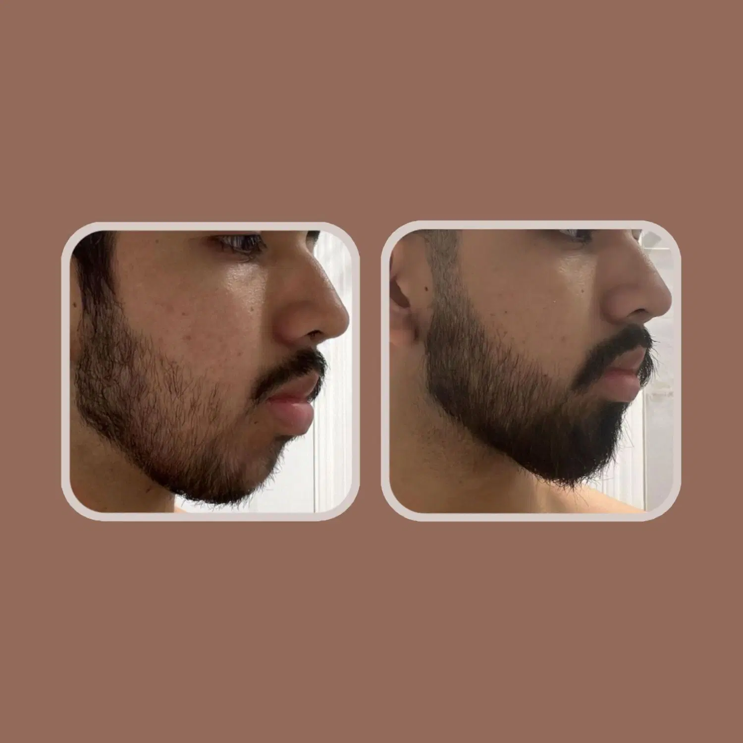 25روزه|آرایشی، بهداشتی، درمانی|اصفهان, عباس‌آباد|دیوار