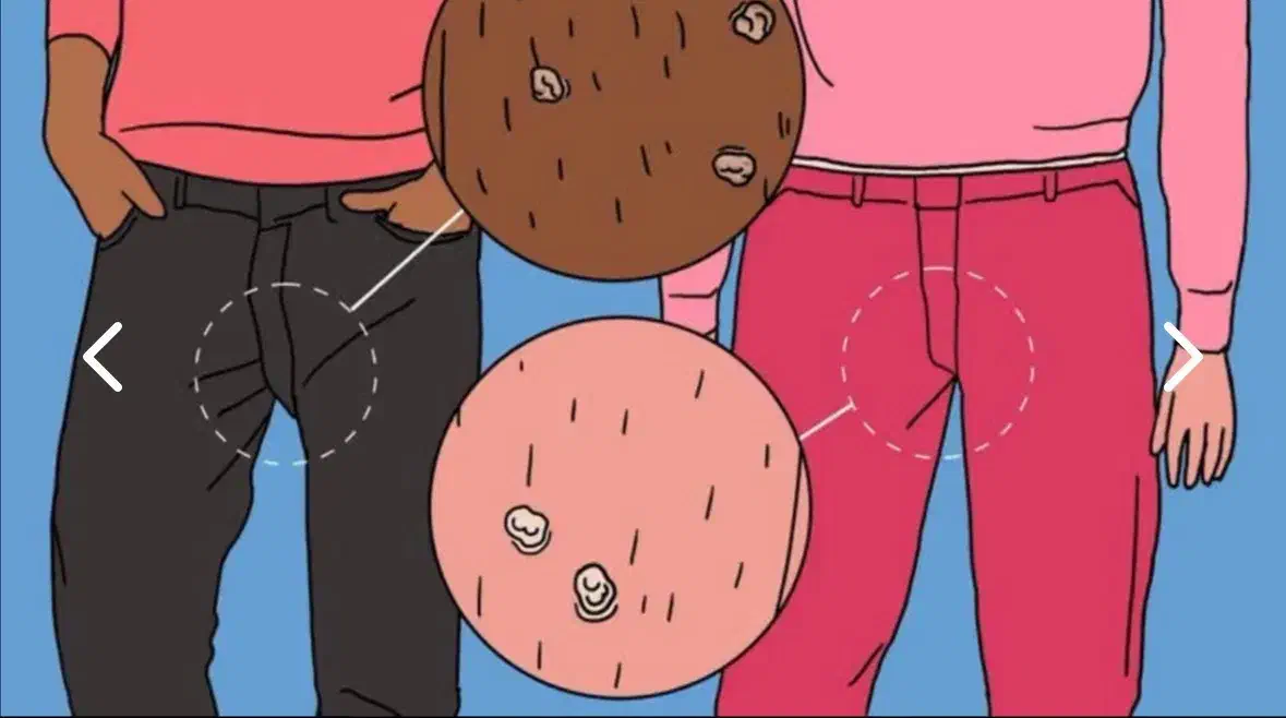 برای همیشه راحت شو|خدمات آرایشگری و زیبایی|کجور, |دیوار