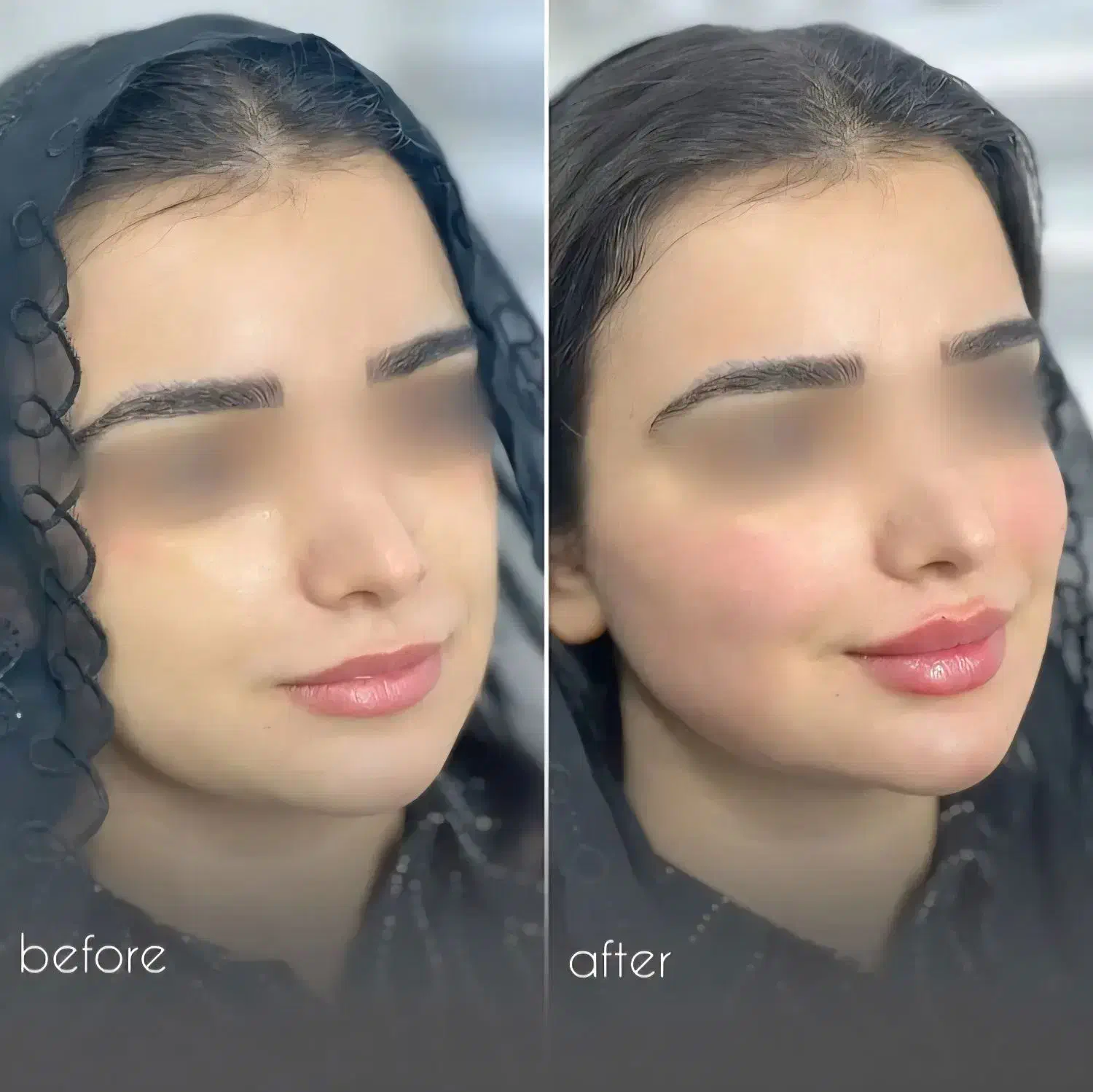 کلینیک زیبایی و پیکرتراشی|خدمات آرایشگری و زیبایی|آمل, |دیوار