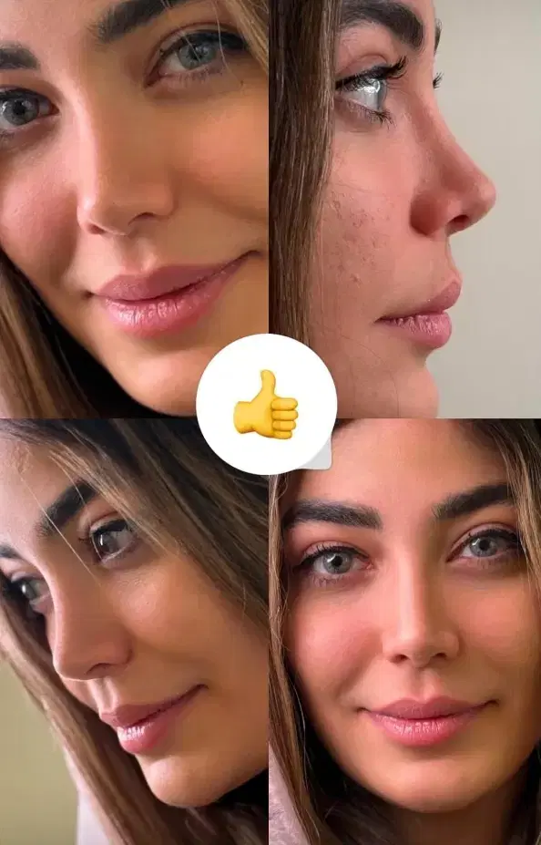 عمل جراحی بینی/ متخصص(ENT)/لیفت صورت|خدمات زیبایی و سلامت|کرج, جهان‌شهر|دیوار