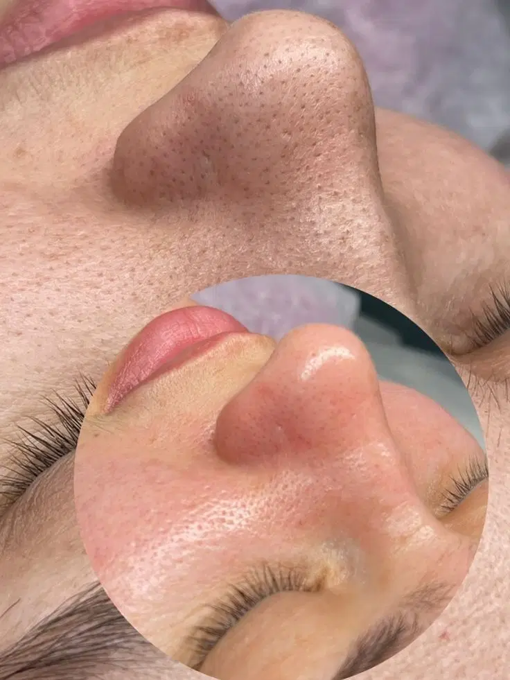پوست شفاف پاکسازی رفع لک|خدمات آرایشگری و زیبایی|کرمانشاه, |دیوار