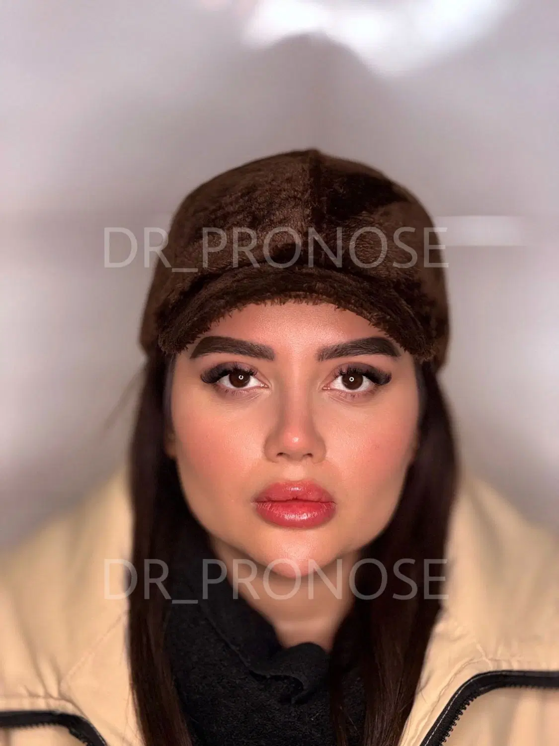 جرا حی،بینی|خدمات آرایشگری و زیبایی|شاهین‌شهر, عطار|دیوار