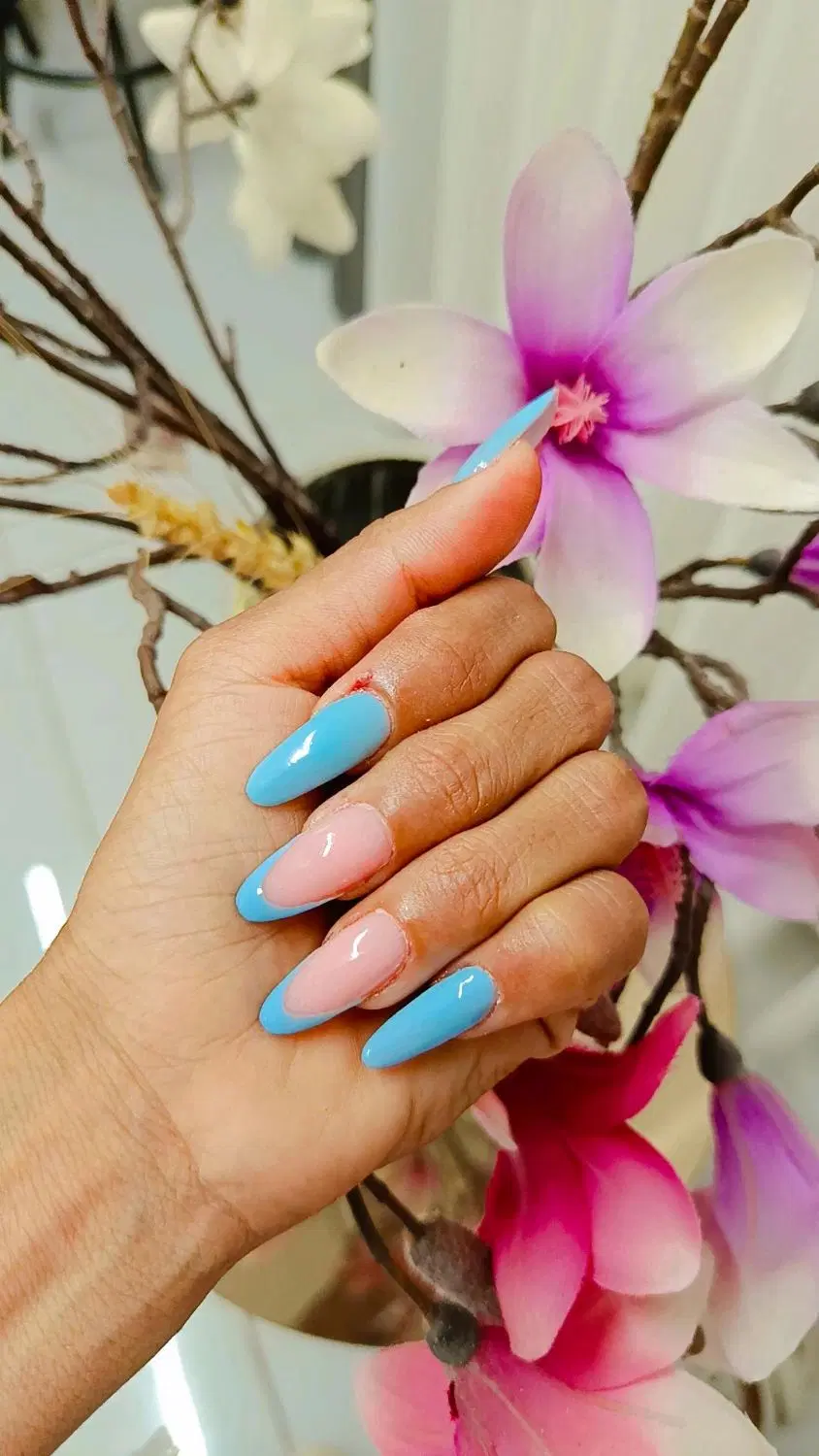 کاشت|خدمات زیبایی و سلامت|یزد, |دیوار