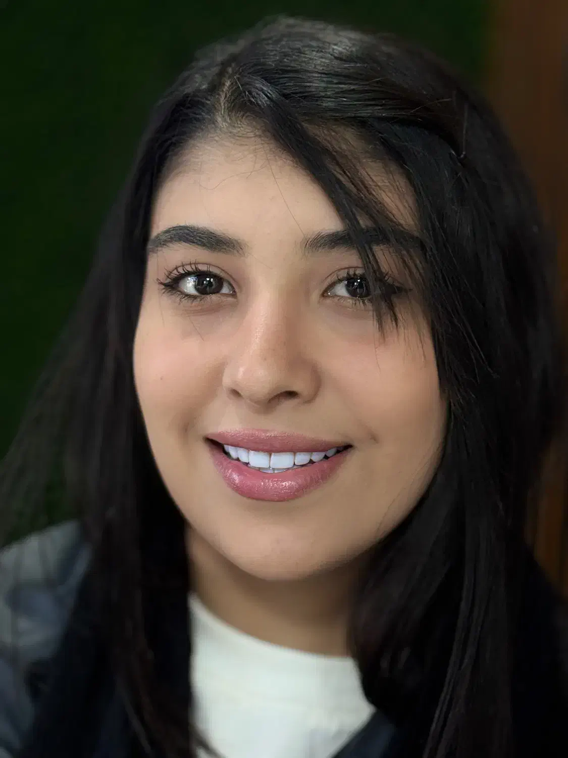 کامپوزیت و کاشت دندان با بهترین متریال و قیمت|خدمات آرایشگری و زیبایی|ساری, |دیوار