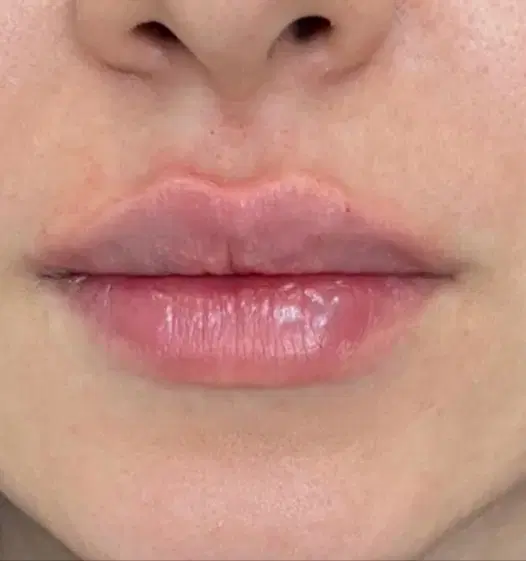 خدمات تخصصی ژل،فیلر،بوتاکس.میکروبلیدینگ ابرو در مرودشت، بیست متری بیمارستان، خ هلال احمر