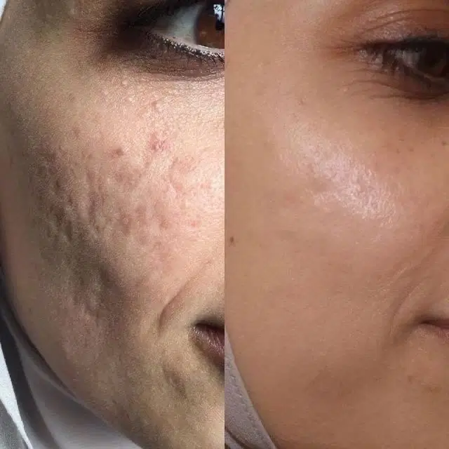 دمودکس|آرایشی، بهداشتی، درمانی|چابهار, |دیوار