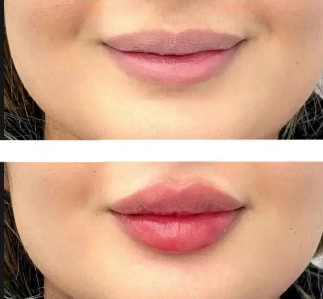 ژل ۹۰۰|خدمات آرایشگری و زیبایی|ایلام, |دیوار