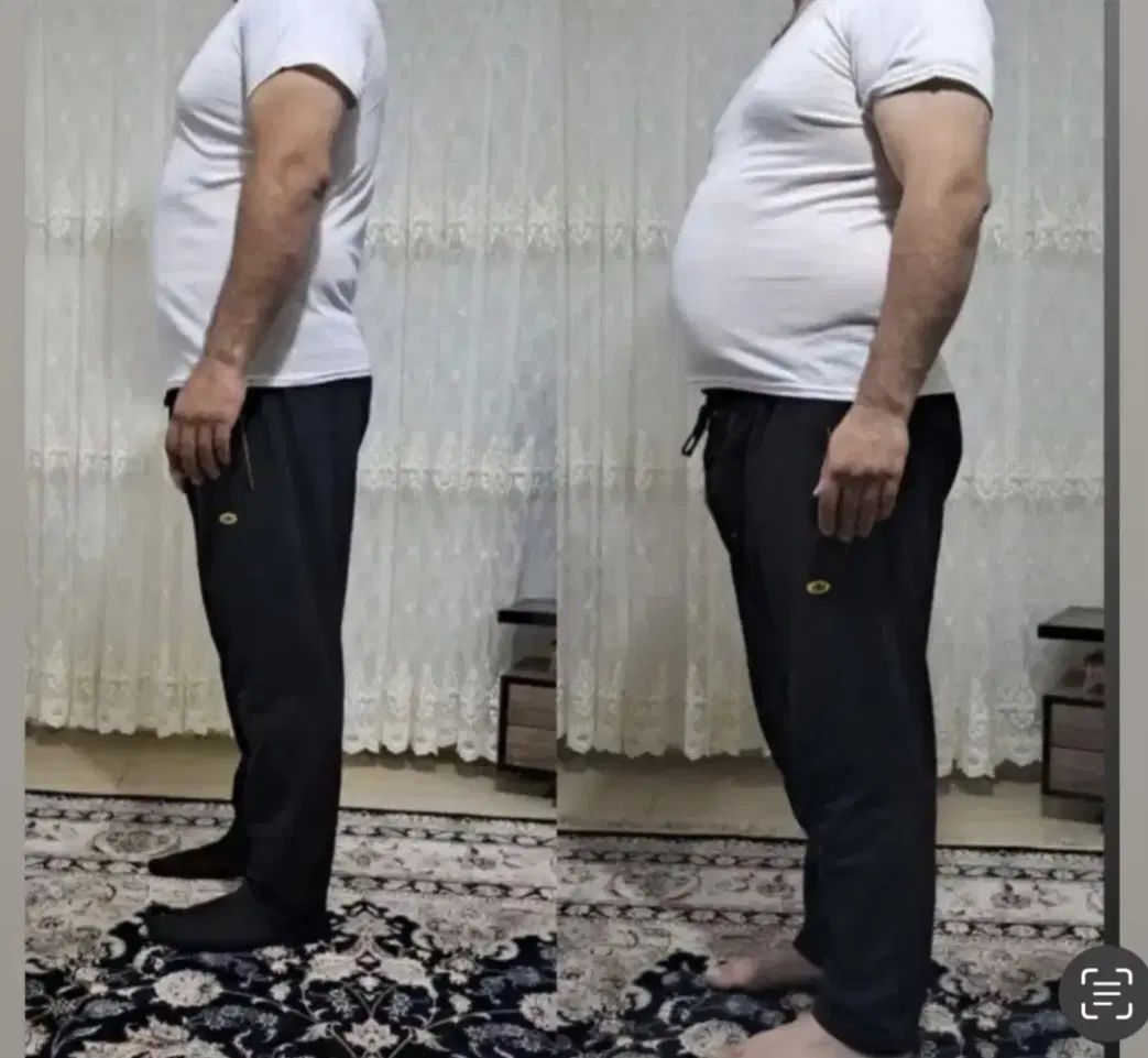کاهش وزن تضمینی همراه مشاوره تخصصی|آرایشی، بهداشتی، درمانی|تهران, چیتگر جنوبی|دیوار