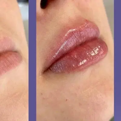 اف لیزر|خدمات آرایشگری و زیبایی|شیراز, شهرک استقلال|دیوار
