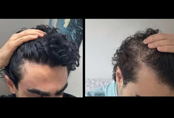تونیک مو رفع ریزش و رویش مجدد مو|آرایشی، بهداشتی، درمانی|اهواز, امانیه|دیوار
