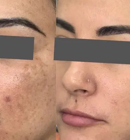پک کرم و صابون ضدلک و روشن کننده صورت اصل|آرایشی، بهداشتی، درمانی|تهران, شهرک غرب|دیوار