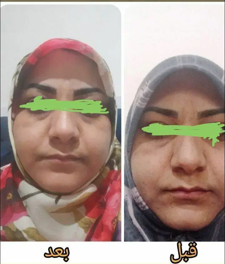 لک قهویی|آرایشی، بهداشتی، درمانی|هشتگرد, مدرس|دیوار