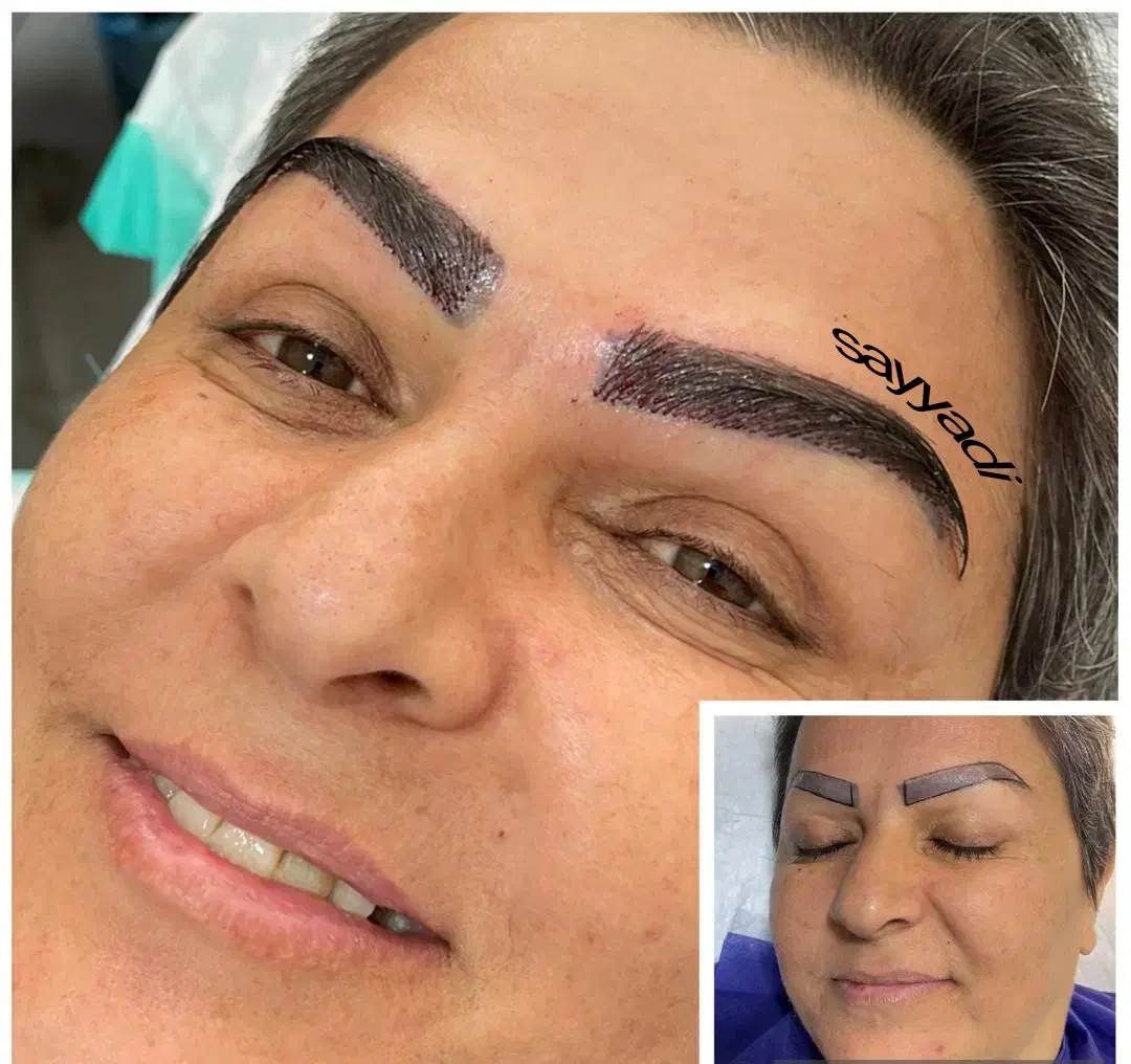 کاشت تخصصی ابرو - تخفیفی باور نکردنی در شیراز، خ قصرالدشت