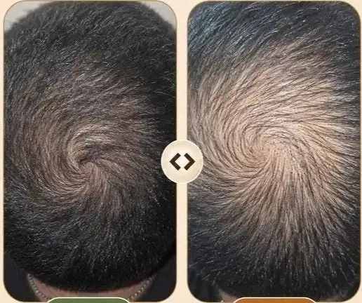 کبدچرب|آرایشی، بهداشتی، درمانی|مشهد, سناباد|دیوار