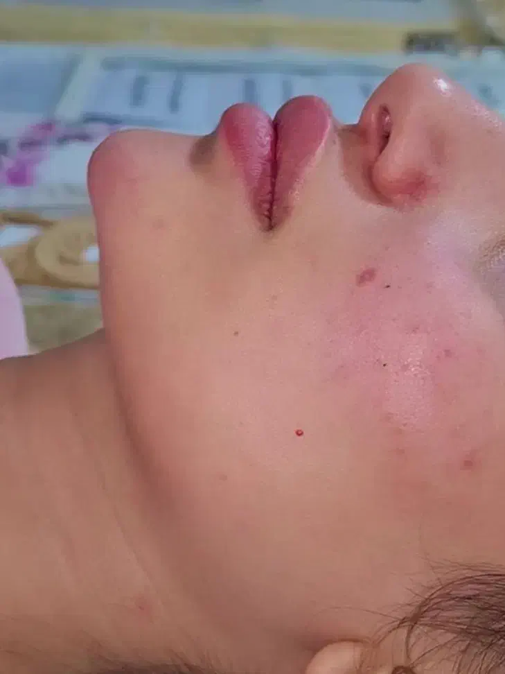 فیلر لب|خدمات آرایشگری و زیبایی|زاهدان, |دیوار