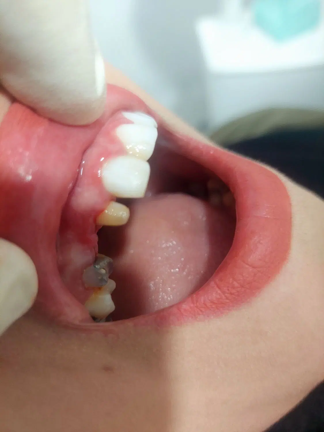 dentist endo|خدمات آرایشگری و زیبایی|کرمانشاه, |دیوار