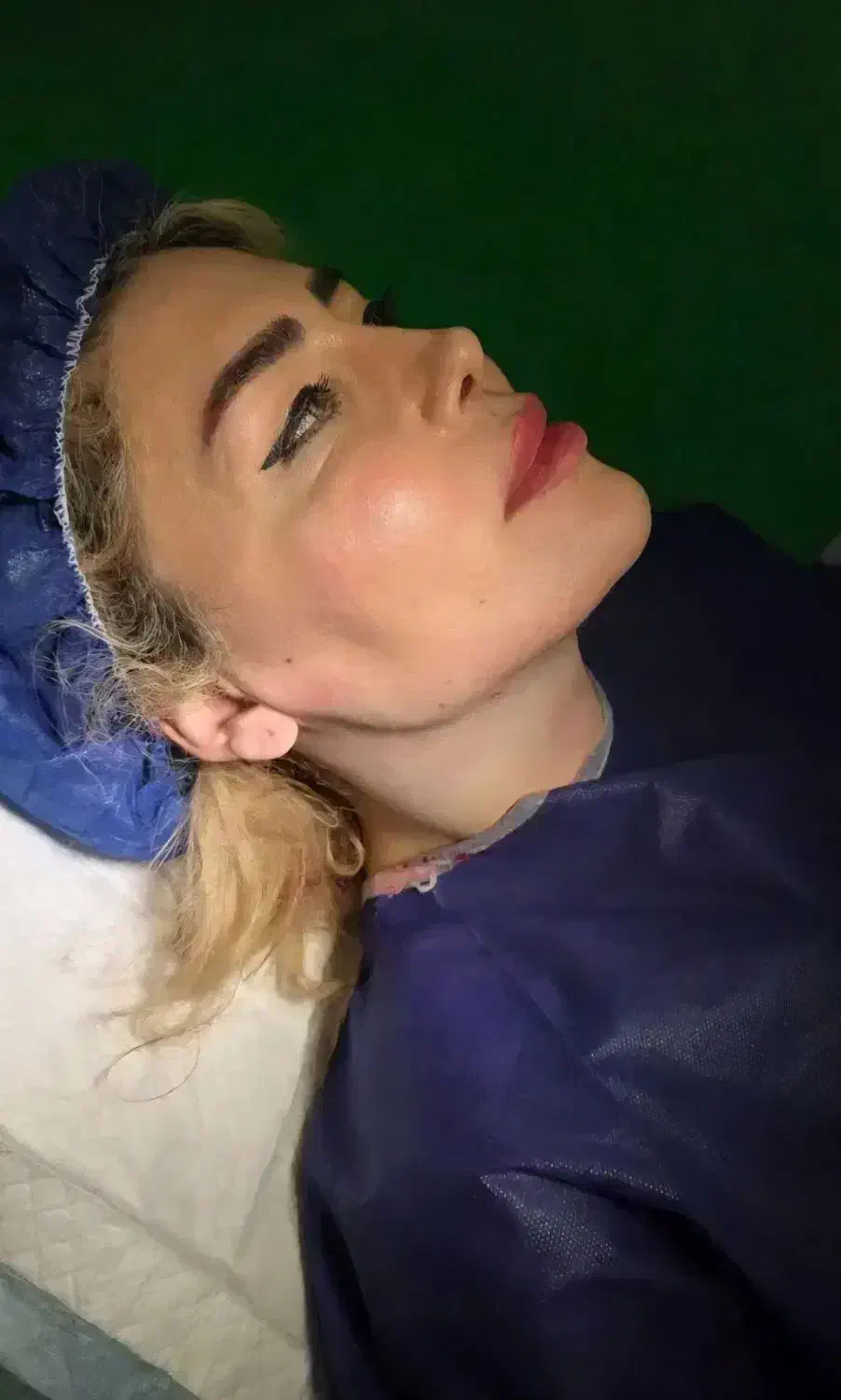 کلینیک زیبایی و پیکرتراشی|خدمات آرایشگری و زیبایی|آمل, |دیوار