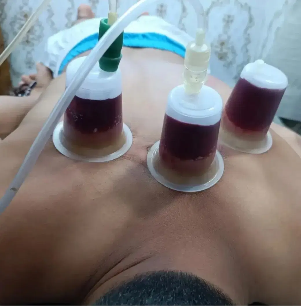 حجامت|خدمات آرایشگری و زیبایی|خرمشهر, |دیوار