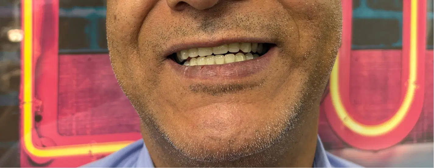 دندان مصنوعی دندانسازی اقساط|خدمات زیبایی و سلامت|کرمان, |دیوار