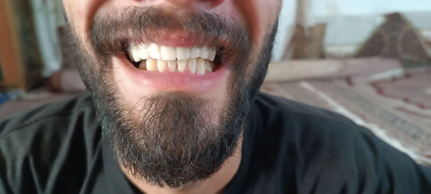 dental|خدمات پیشه و مهارت|کرمانشاه, |دیوار