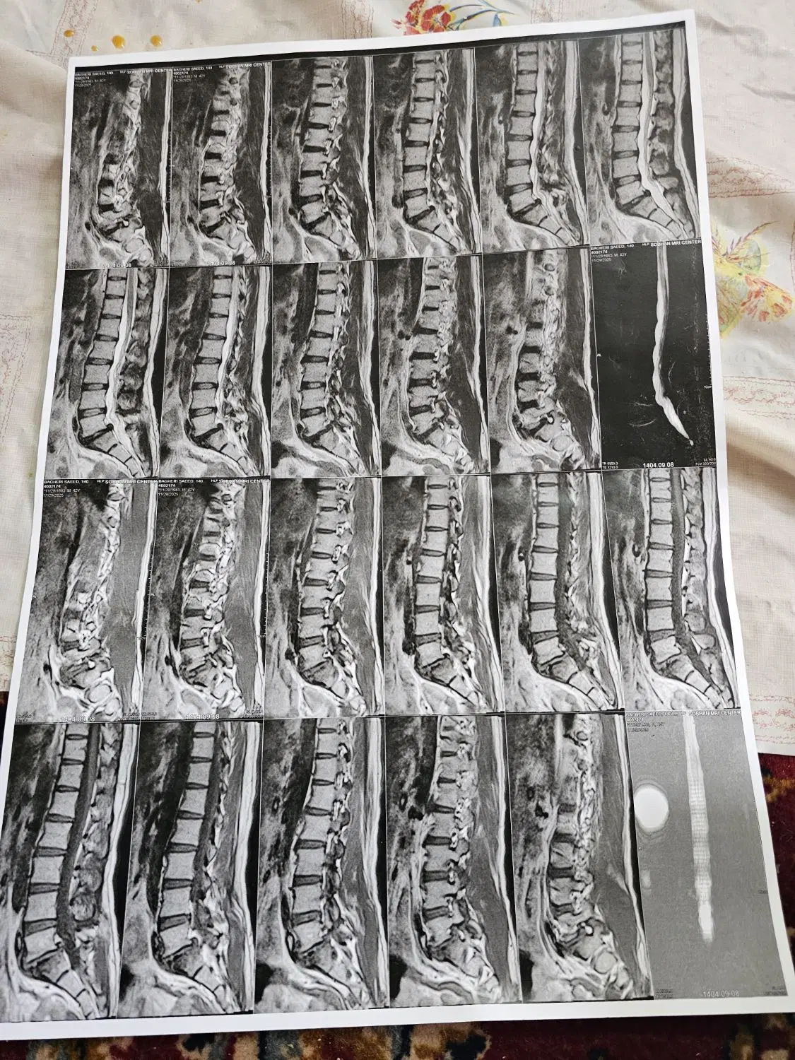 زالو،حجامت،فصد خون،مشاوره طب سنتی|خدمات زیبایی و سلامت|یزد, |دیوار