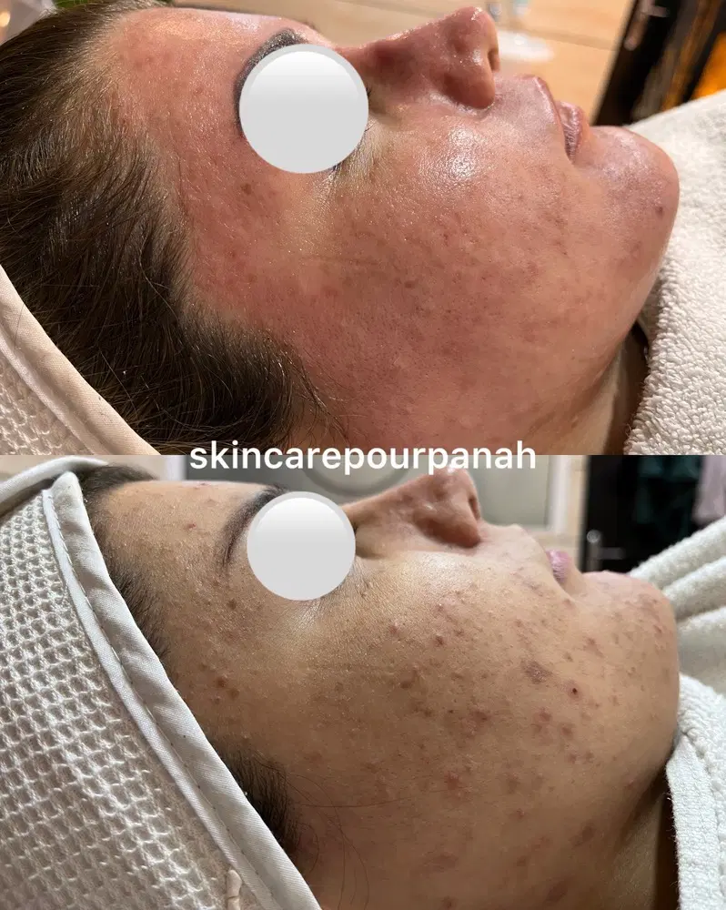 فشیال|خدمات آرایشگری و زیبایی|سلماس, |دیوار