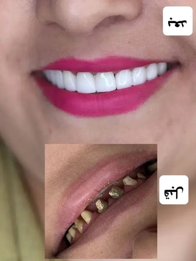زیبایی|خدمات آرایشگری و زیبایی|خوی, |دیوار