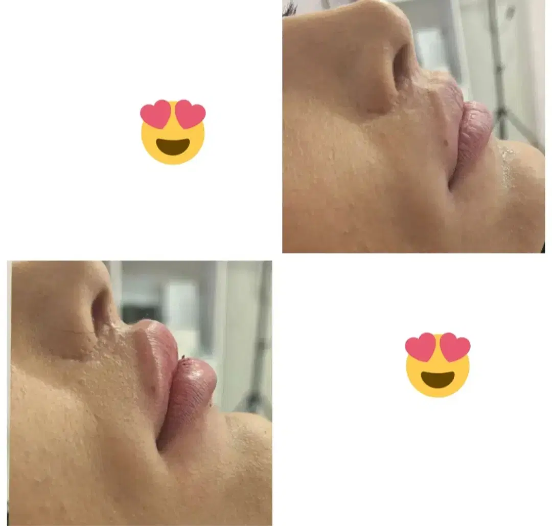 فیلر|خدمات زیبایی و سلامت|صحنه, |دیوار