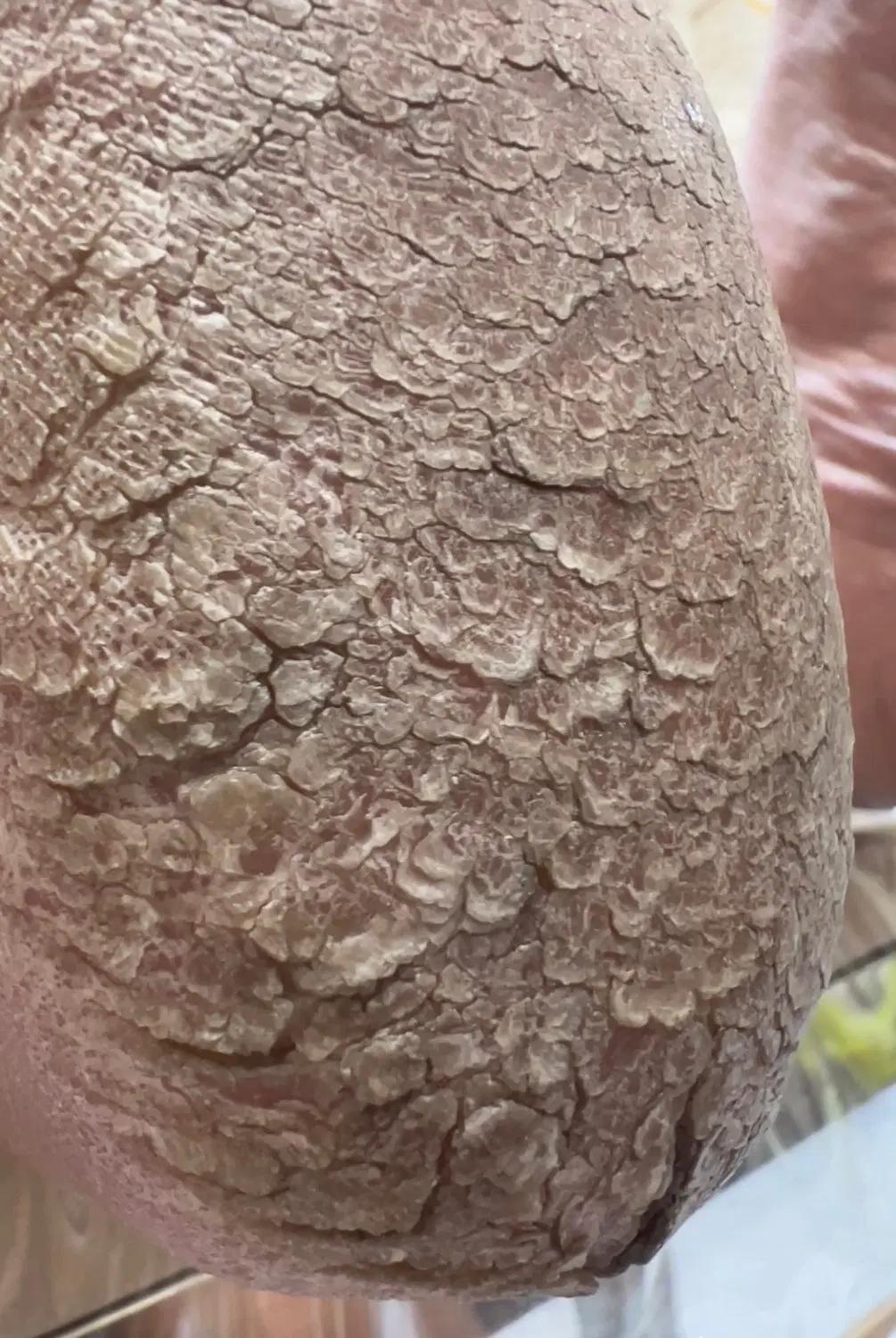 پدیکور|خدمات زیبایی و سلامت|مهاباد (آذربایجان غربی), |دیوار