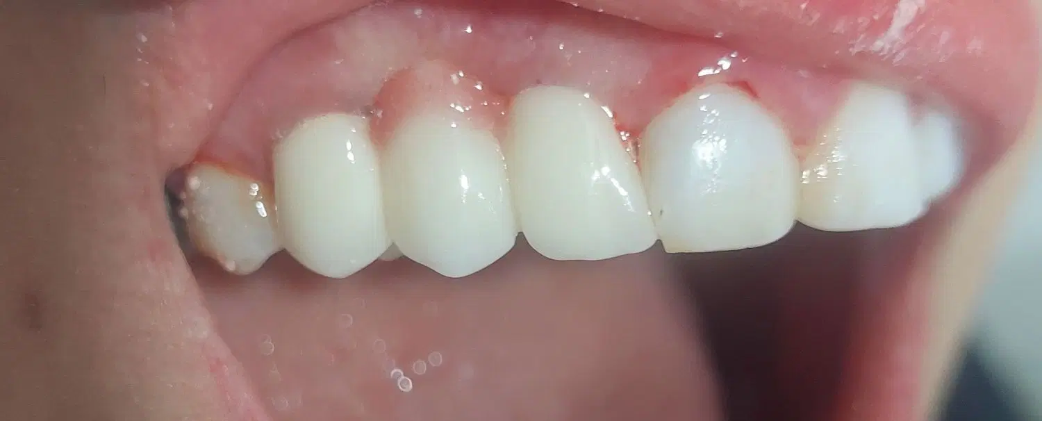 dentist endo|خدمات آرایشگری و زیبایی|کرمانشاه, |دیوار