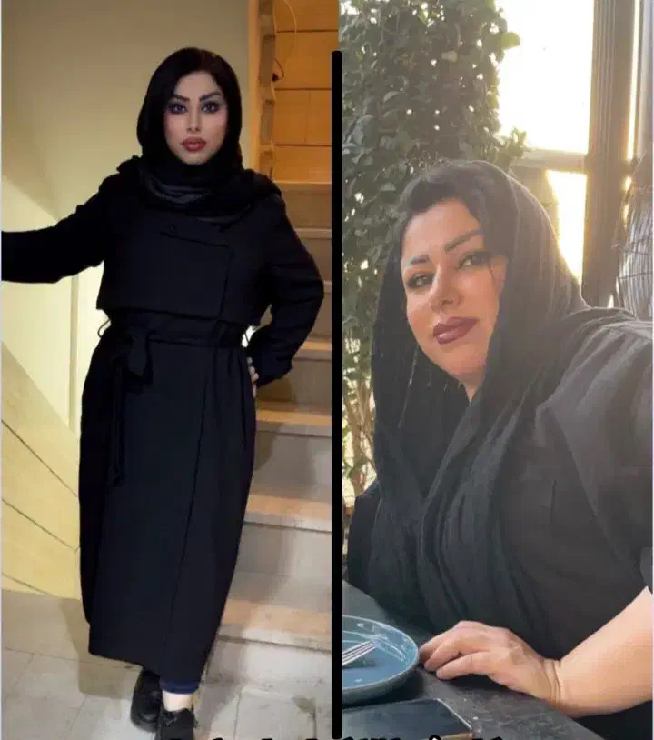 جراحی اسلیو معده ، مشاوره و بررسی رایگان|خدمات آرایشگری و زیبایی|تهران, نیاوران|دیوار