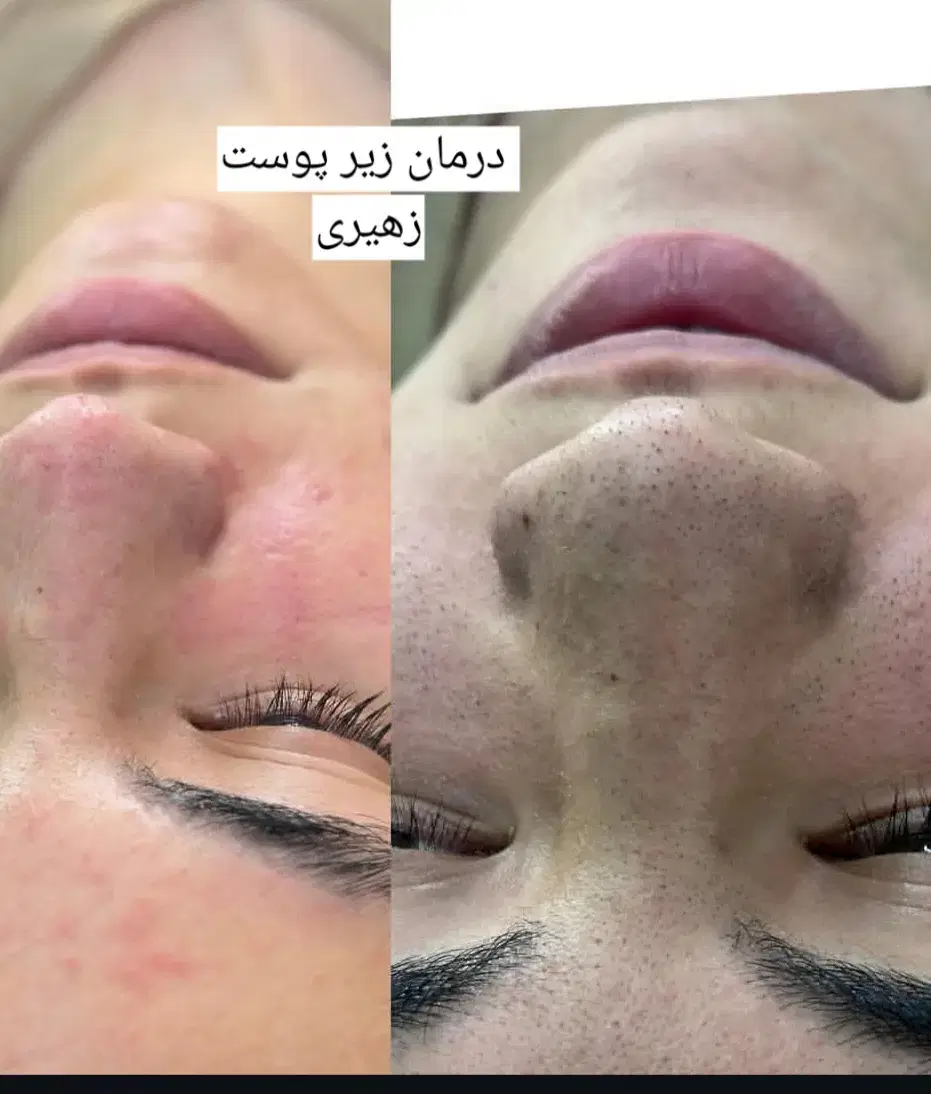 زیبایی|خدمات آرایشگری و زیبایی|اهواز, کیانشهر|دیوار