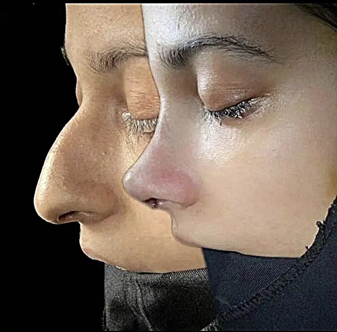 عمل بینی|خدمات آرایشگری و زیبایی|رامشیر, |دیوار