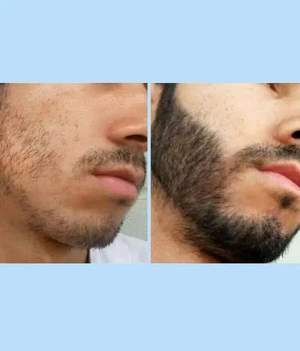مرد شو|آرایشی، بهداشتی، درمانی|تویسرکان, |دیوار