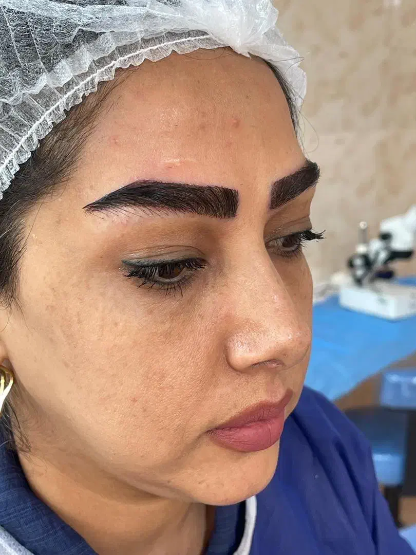 کاشت مو شیرازی کاشت ابرو طبیعی کاشت ریشvip|خدمات آرایشگری و زیبایی|آمل, |دیوار