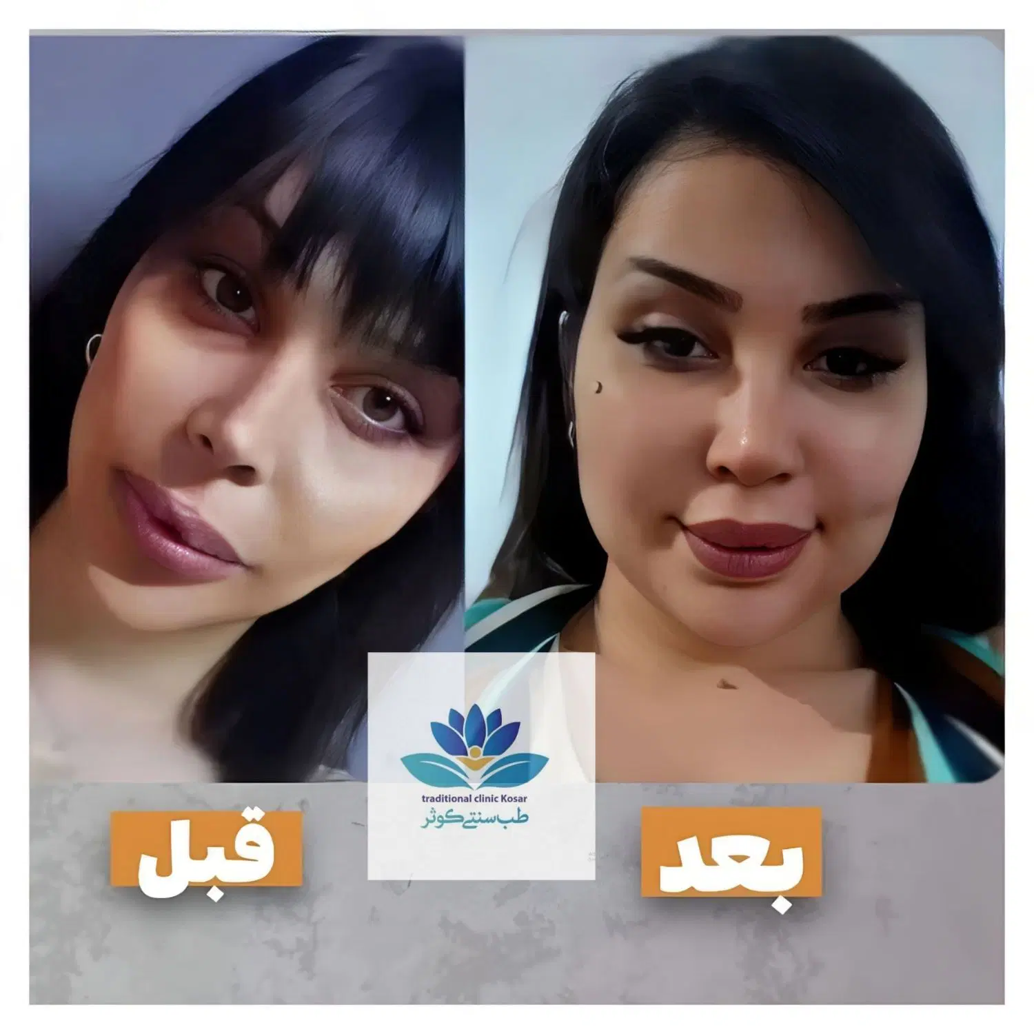 تپل شو|آرایشی، بهداشتی، درمانی|چالوس, |دیوار