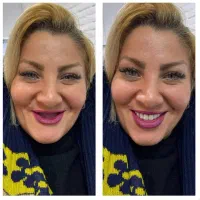 دندانسازی/دندان مصنوعی/بامجوزرسمی و ۸۰سال سابقه
