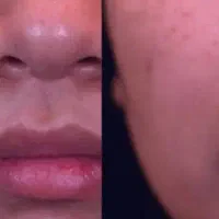 خال برداری