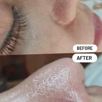 فیشیال پاکسازی و درمان تضمینی پوست|خدمات آرایشگری و زیبایی|کرمانشاه, |دیوار