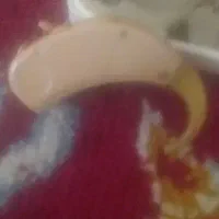 سمعک طبی