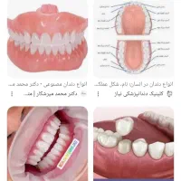 دندان پزشکی