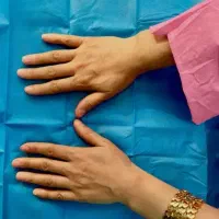 تزریق چربی صورت و باسن - فیلر بادی سینه و هیپ دیپ
