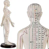 طب سوزنی،درمان میگرن و مشکلات گوارش و...