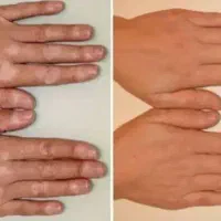 لکه های سفید رو جدی بگیر