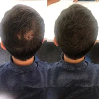 جز این راه دیگه ای نداری برای موهات