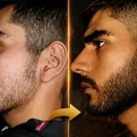 تونیک رویش ریش