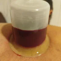 حجامت با بادکش