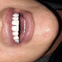 دندانسازی