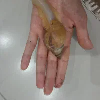 حلزون