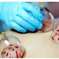 کارهای تزریقات و حجامت خانم هادر منزل انجام میشود.
